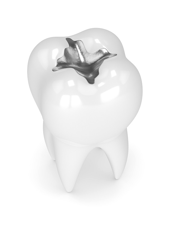 What Is Your Cavity Risk?