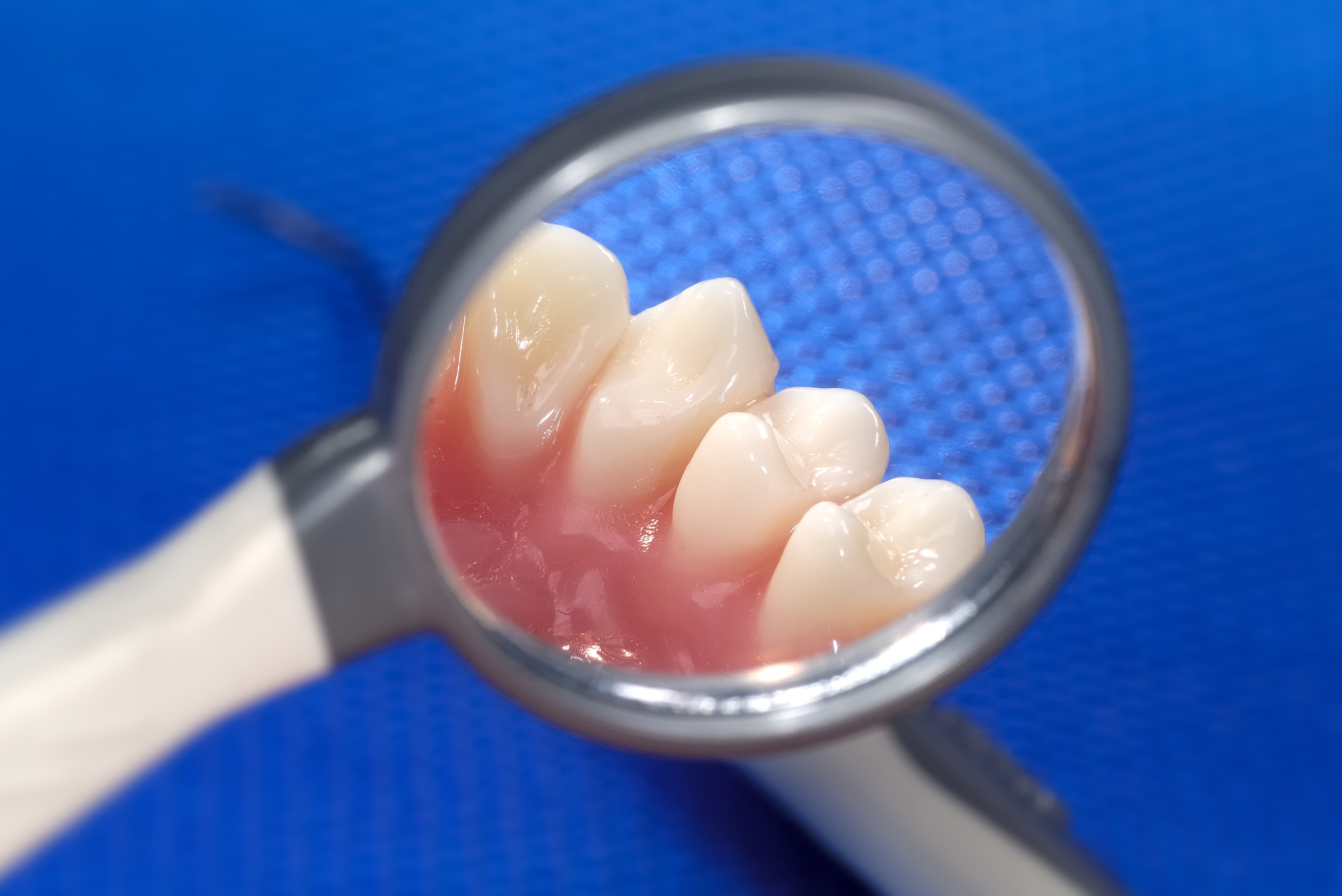 Could New Dental Gel Repair Tooth Enamel?