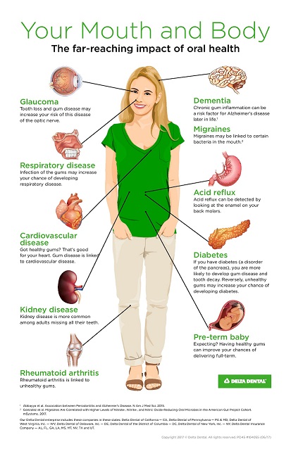 Glaucoma Mouth and Body