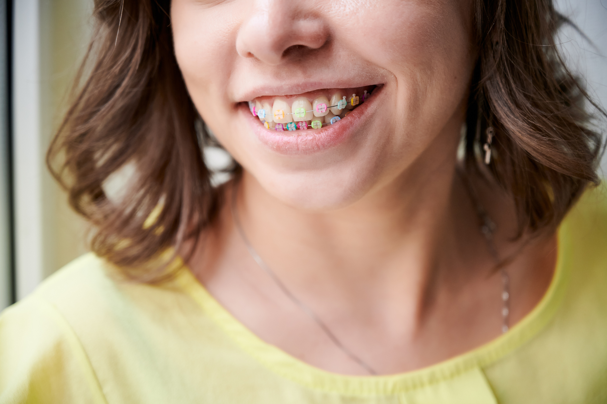 Take the Guess Work out of Choosing Your Ortho Bands