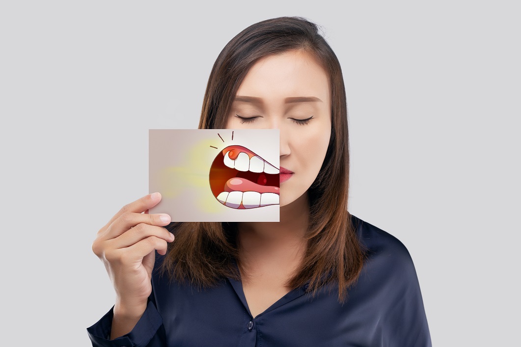 Periodontitis Causes and Risk Factors